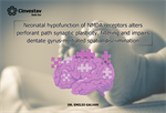 Neonatal hypofunction of NMDA receptors alters perforant path synaptic plasticity, filtering and impairs dentate gyrus-mediated spatial discrimination