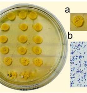 Exiguobacterium: Avances en su aplicación como probiótico en la acuicultura
