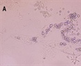 Efecto nematicida del extracto de Canavalia ensiformis y su potencialización con nanopartículas contra Meloidogyne incognita