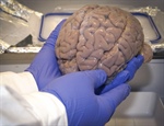 Contribuciones del Cinvestav en torno al órgano más complejo: el cerebro