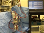 Desarrollan sensor para detectar coagulación de sangre en segundos